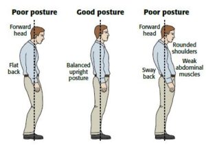 poor posture
